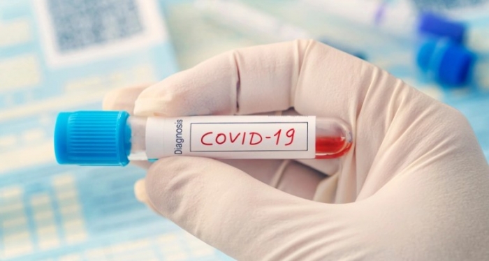 Mais de 1.000 casos positivos de Covid são registrados em Petrolina